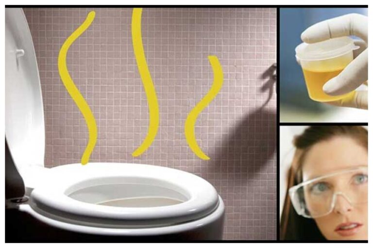 Urine Smell Problem: इन वजहों से यूरिन से आती है बेहद ही गंदी बदबू, आज ही छोड़ें
