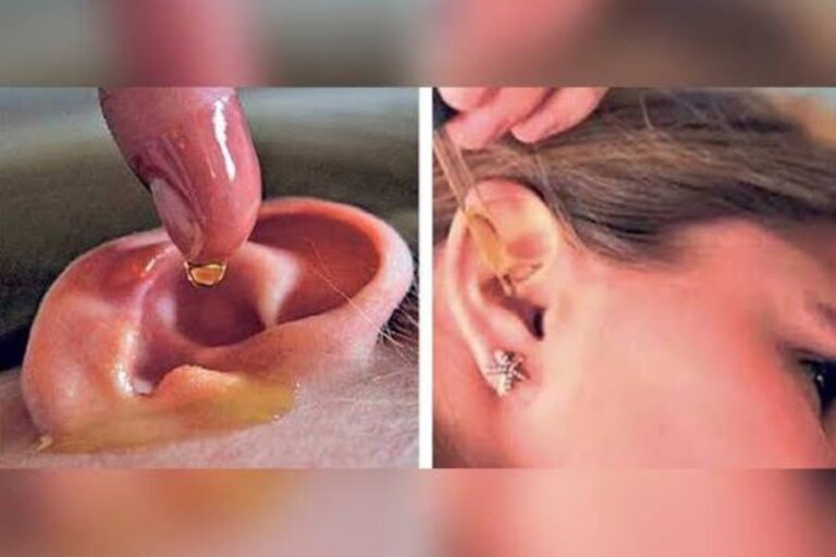 जानलेवा हो सकती है बच्चों के कान में तेल डालने की आदत, जानिए इसके साइड इफैक्ट्स