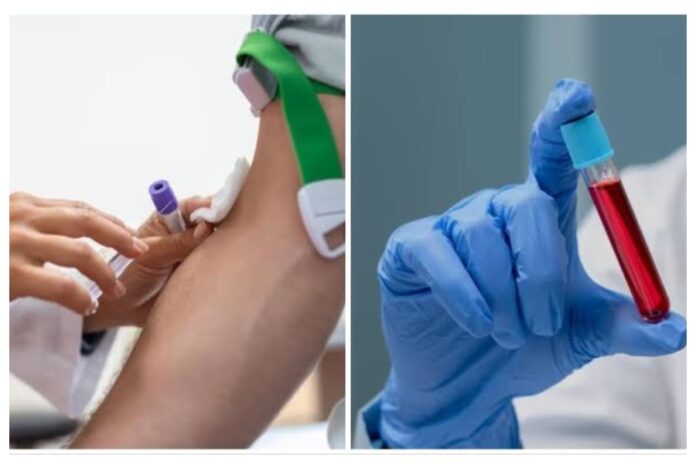 Bleeding disorder