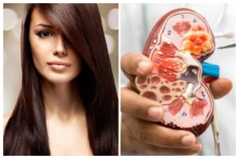हेयर स्ट्रेट करवाने के वजह से लड़की की किडनी हो गई खराब, बालों में इस्तेमाल होने वाले क्रीम में मिला यह खतरनाक केमिकल