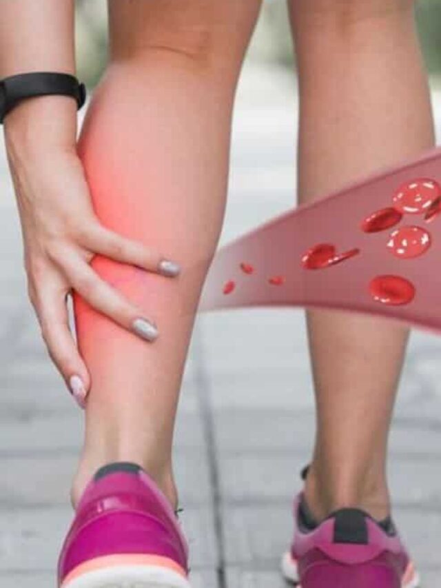 Leg Attack symptoms : हार्ट अटैक से ज्यादा खतरनाक होता है लेग अटैक, जानिए इसके लक्षण
