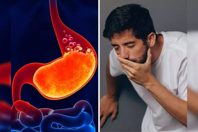 Acidity Problem: गर्मियों में परेशान कर रही है एसिडिटी की समस्या, तो इन चीजों का करें सेवन, पेट रहेगा साफ