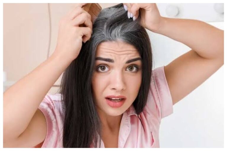 White Hair Remedies: सफेद होते बालों ने कर दिया है परेशान, तो करें यह घरेलू उपाय, तेजी से काले होंगे बाल