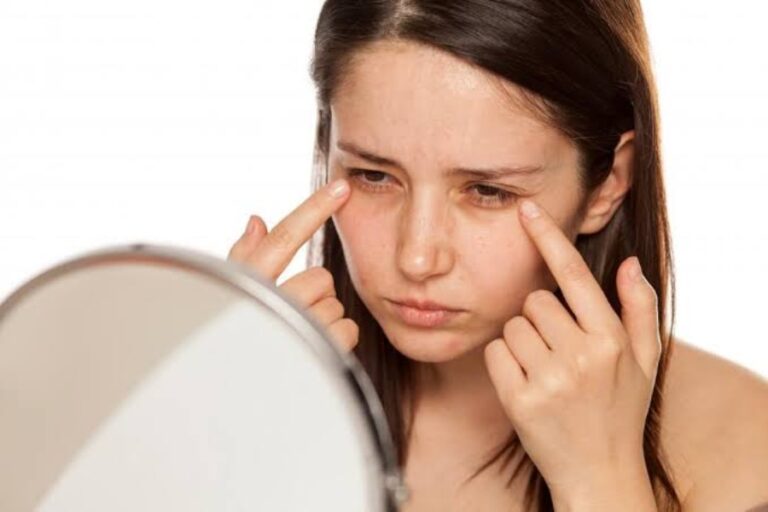 Dark Circles: सिर्फ नींद की कमी ही नहीं बल्कि इन 8 वजहो से भी होते हैं डार्क सर्कल्स, जानिए यहां