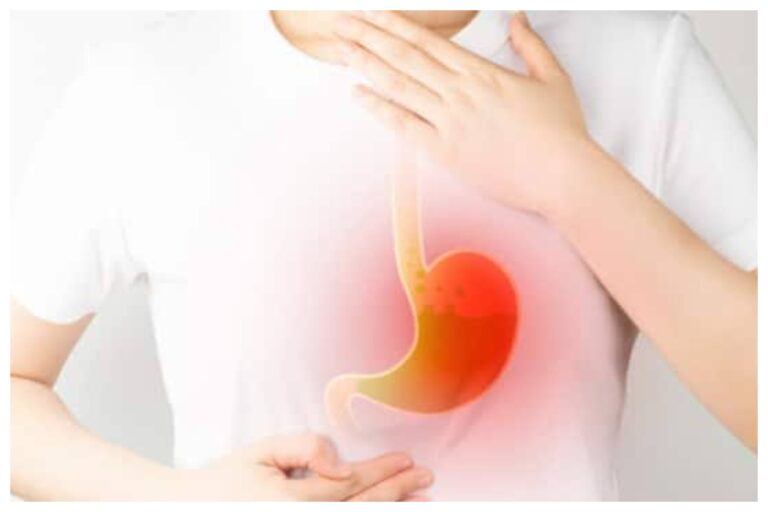 Acidity Problem: एसिडिटी की समस्या ने कर दिया है जीना मुहाल, इन घरेलू उपाय से मिलेगी राहत