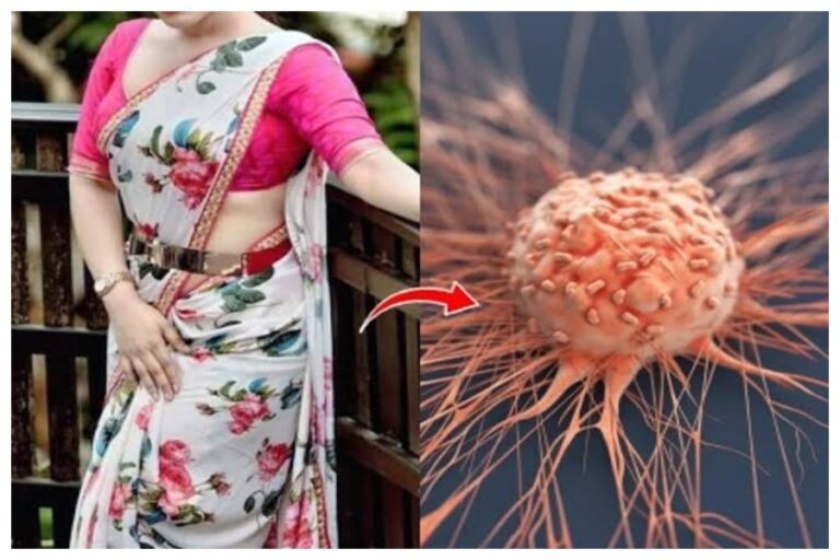 Saree Cancer: जानिए क्या होता है साड़ी कैंसर, तेजी से फैल रही है यह बीमारी
