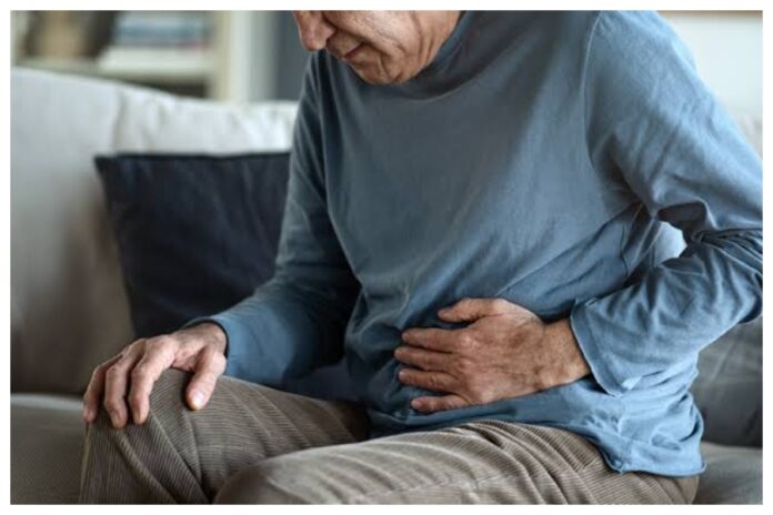 Colon Cancer
