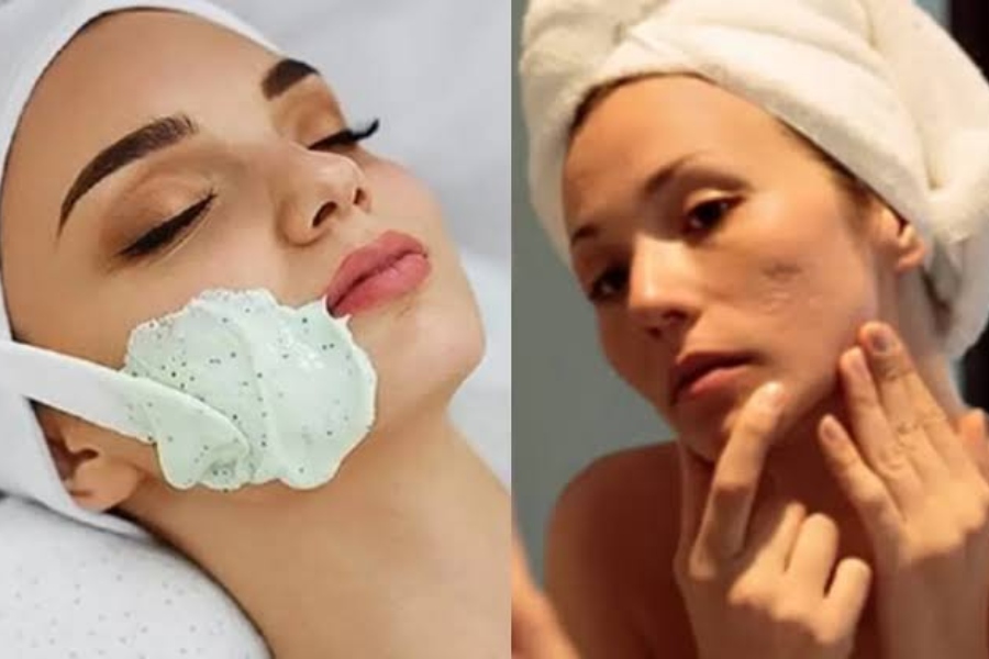 Skin Care Tips