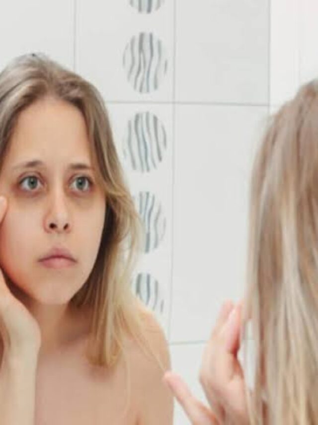 Dark Circles: सिर्फ नींद की कमी ही नहीं, आंखों के नीचे पड़े काले घेरों के पीछे होते हैं ये 8 बड़े कारण!