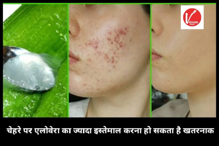 Side Effects Of Aelovera: रोजाना करते हैं एलोवेरा का इस्तेमाल तो हो जाएं सावधान, इन गंभीर बीमारियों के हो सकते हैं शिकार