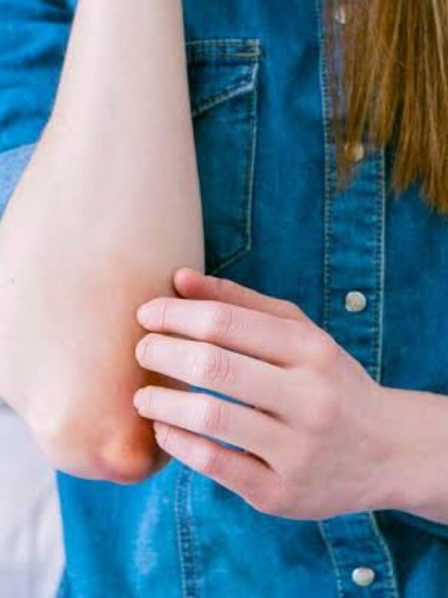 Black Elbow Problem