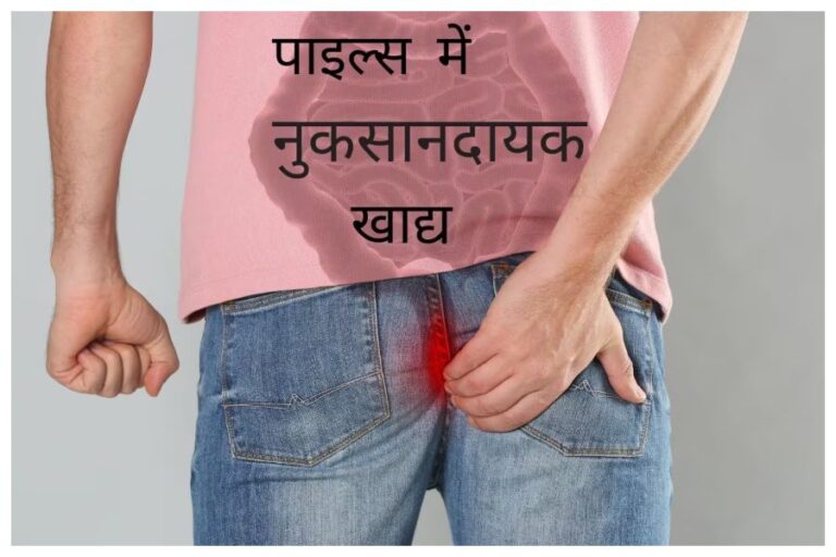 Piles Remedition: पाइल्स के मरीजों को खाने-पीने का खास ध्यान, ये खाएं और ये नहीं..