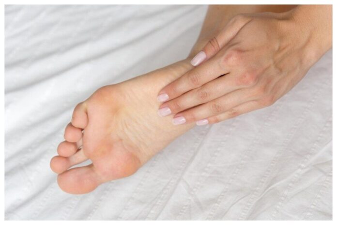 Uric Acid