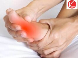 Uric Acid