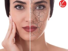 Dry skin
