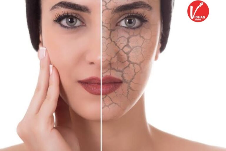 Dry skin