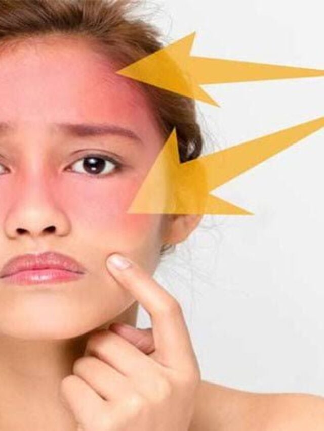 Skin Care Tips