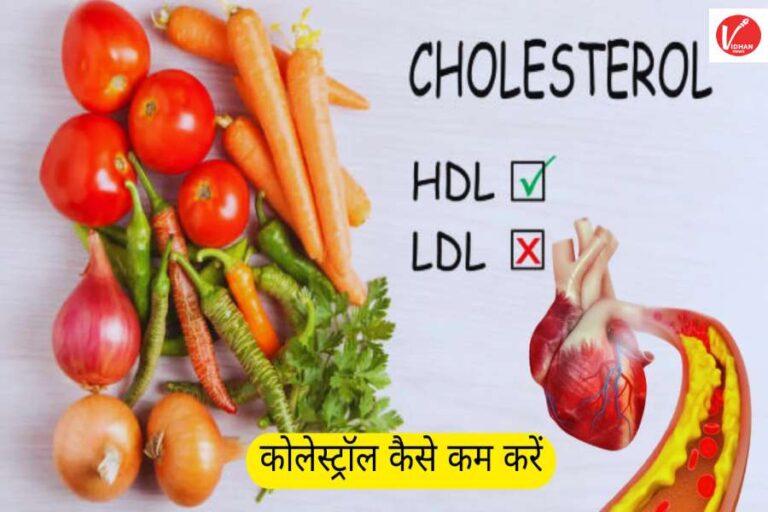 Cholesterol Control