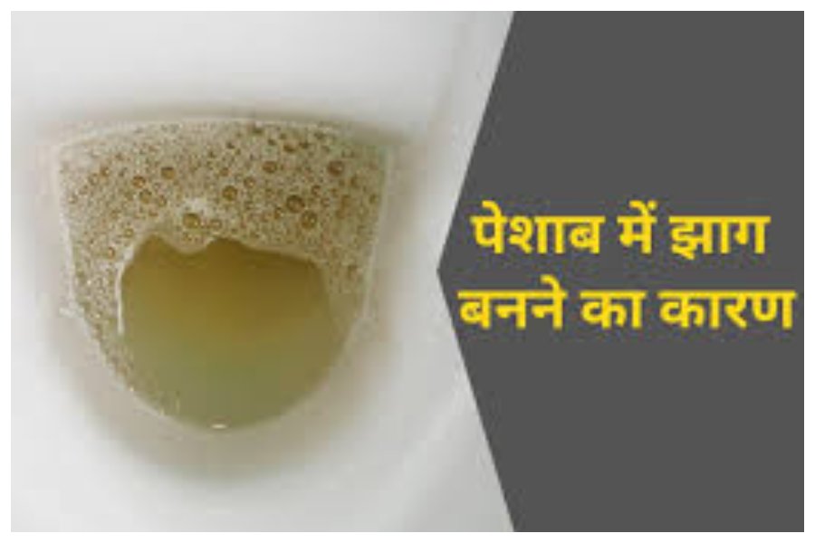 Foamy Urine Causes