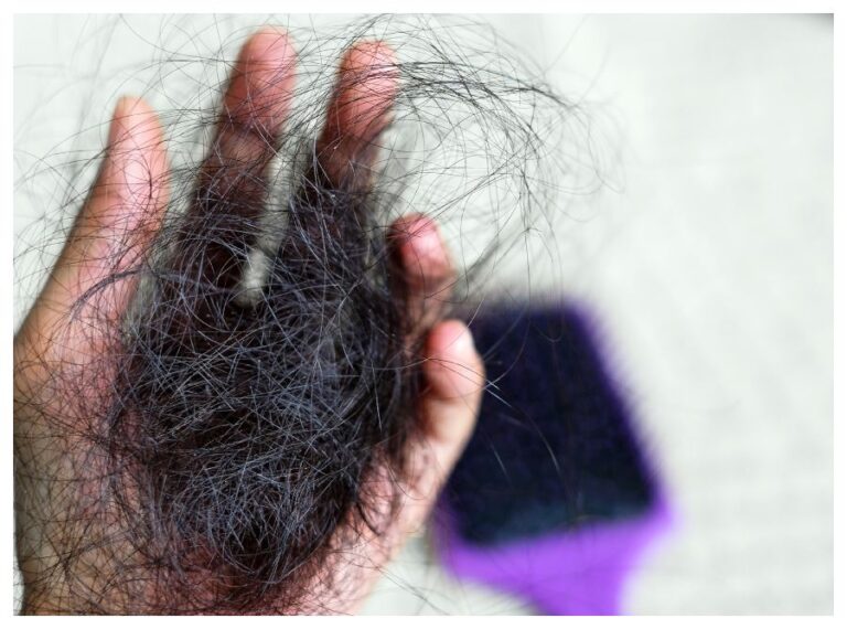 Hair Falling In Monsoon: मानसून में झड़ रहे हैं लगातार बाल, तो नाभि में लगाएं ये तेल, लंबे होने के साथ बनेंगे चमकदार भी.