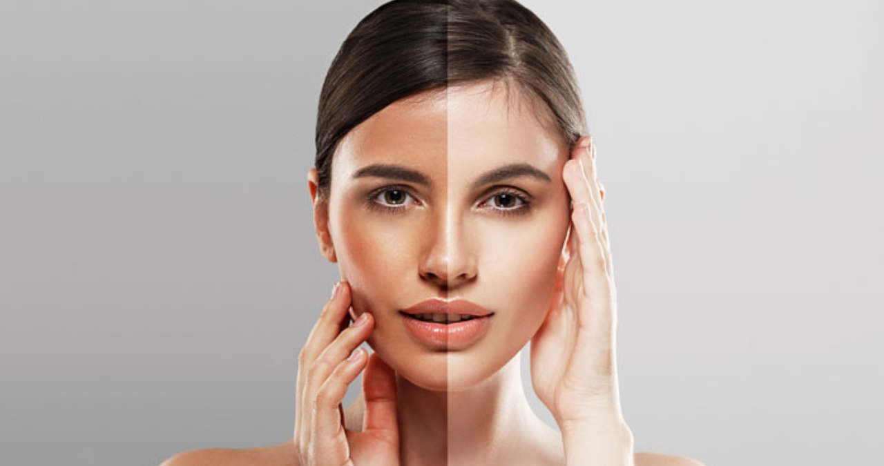 Home remedies for sun tanning
