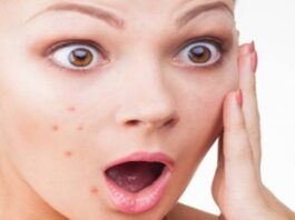 Pimples on Face