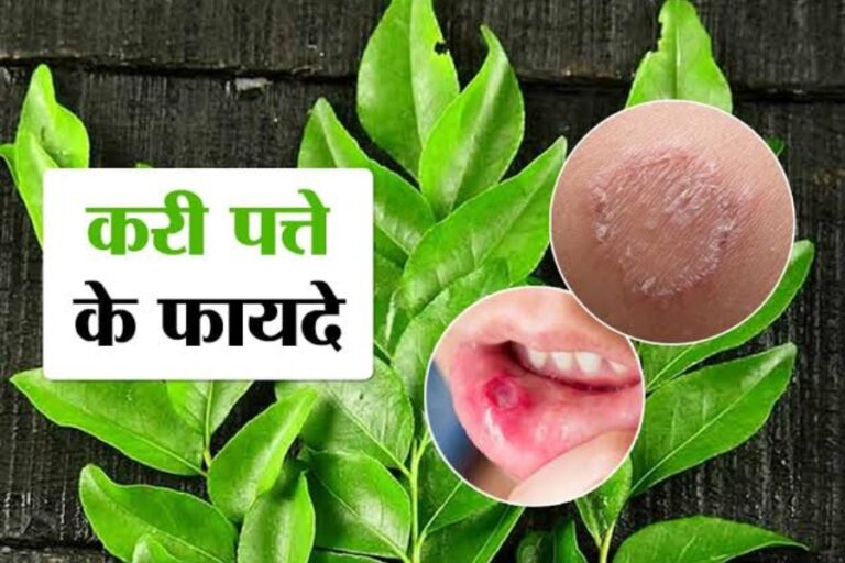 Curry Leaves Benefits