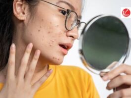 Skin Care Tips