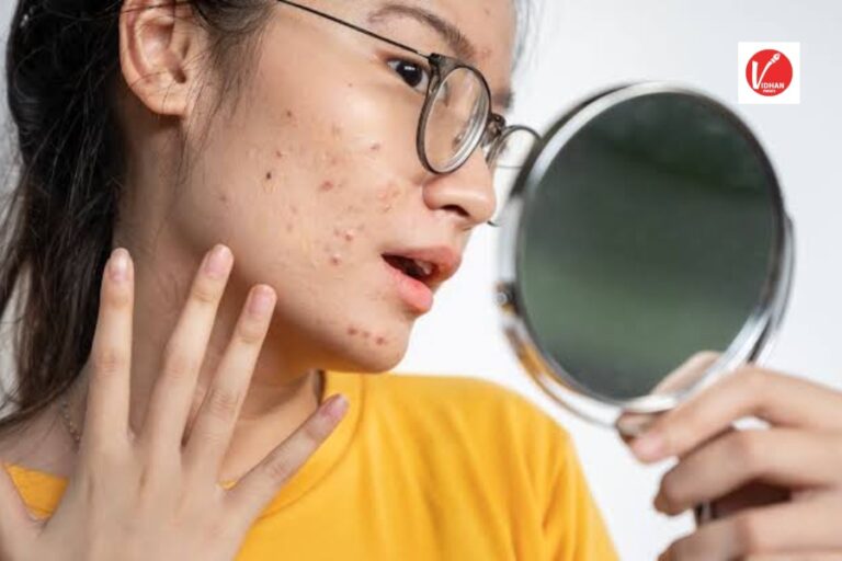 Skin Care Tips