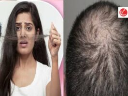 Hair Care Tips