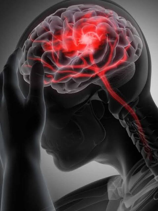 Brain Tumor Symptoms
