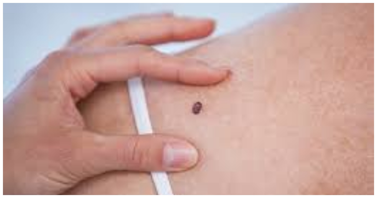 effect of climate change on skin