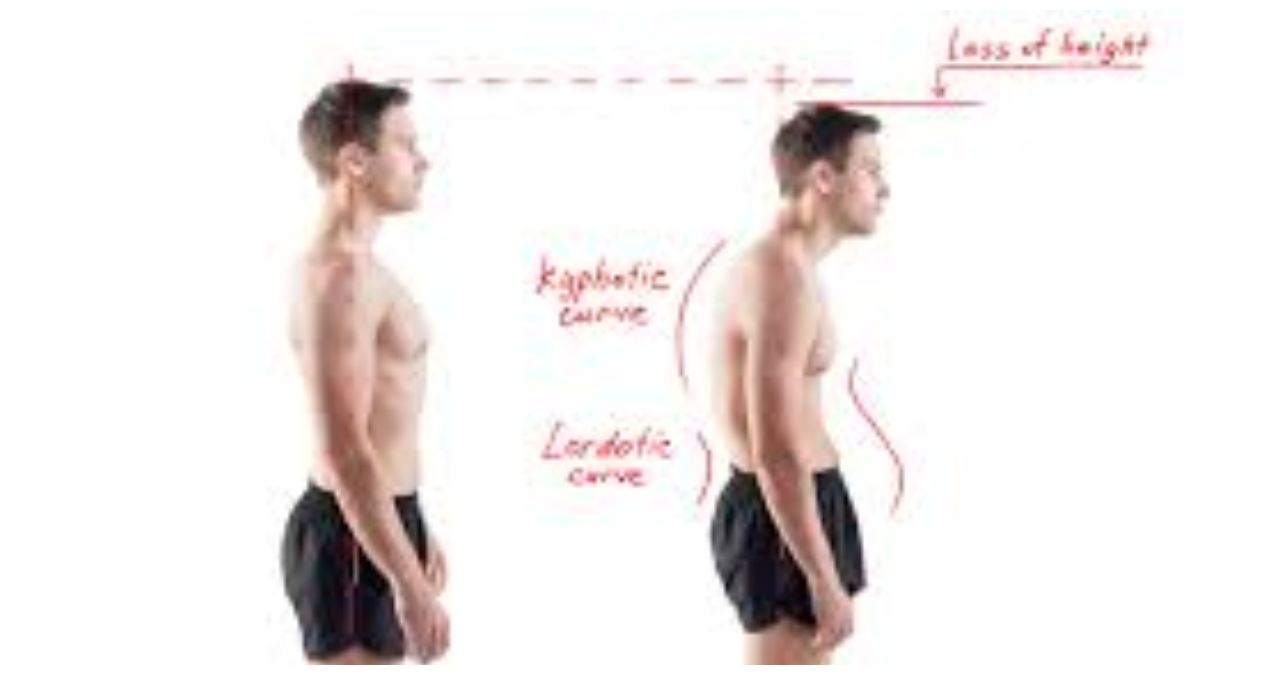 improve posture