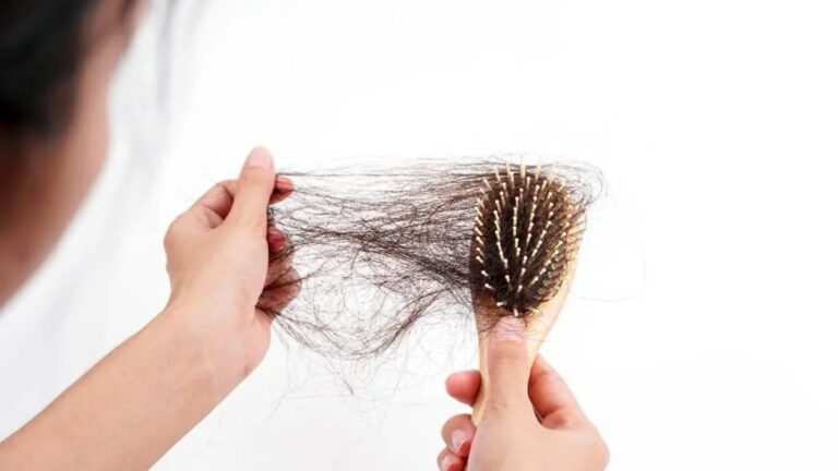 Hair Fall
