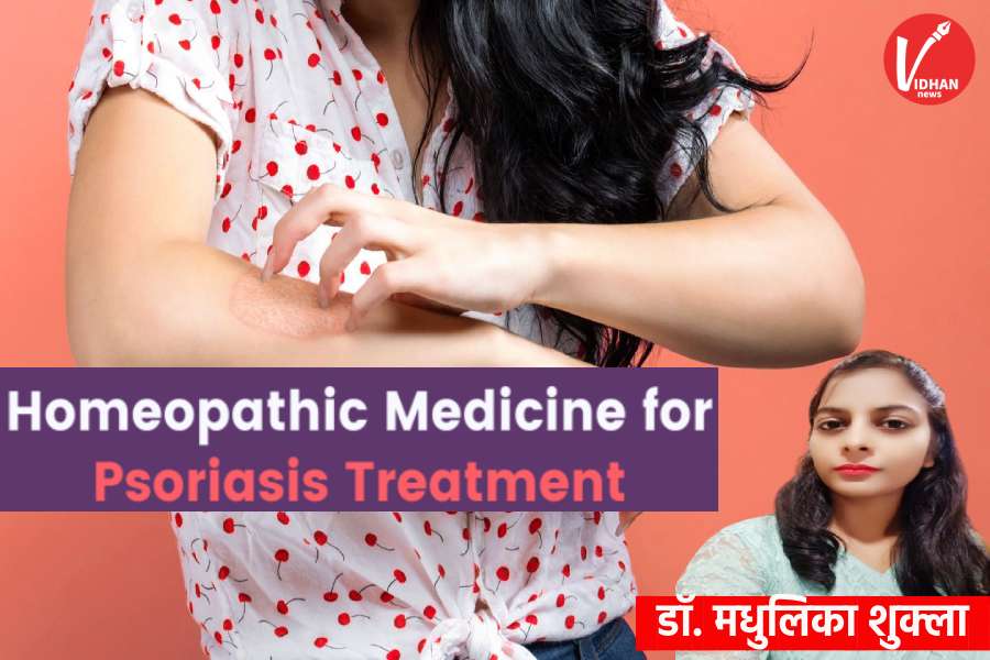 Psoriasis Treatment in Homeopathy