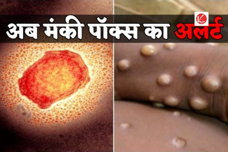 Monkey Pox Virus: भारत में मंकीपॉक्स वायरस को लेकर जारी हुआ हाई अलर्ट, जाने क्या है इस बीमारी के लक्षण और बचाव के उपाय