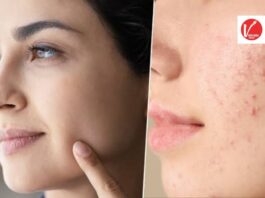 Skin Care Tips