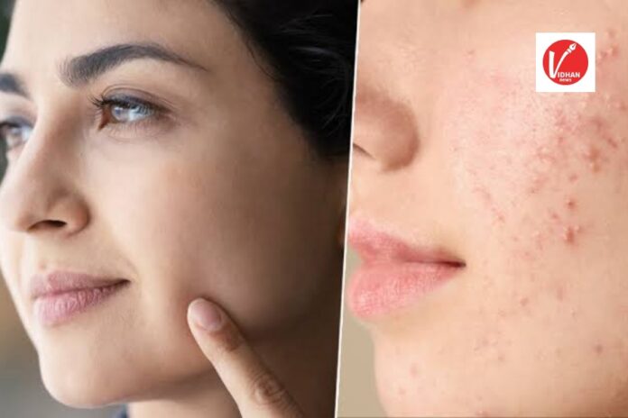 Skin Care Tips Skin Care Tips