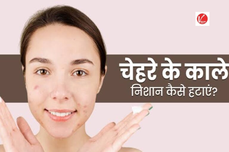 Skin Care Tips: चेहरे से दाग धब्बे दूर करने के लिए इन चीजों का करें इस्तेमाल, चंद दिनों चांद सी चमक जाएगी त्वचा