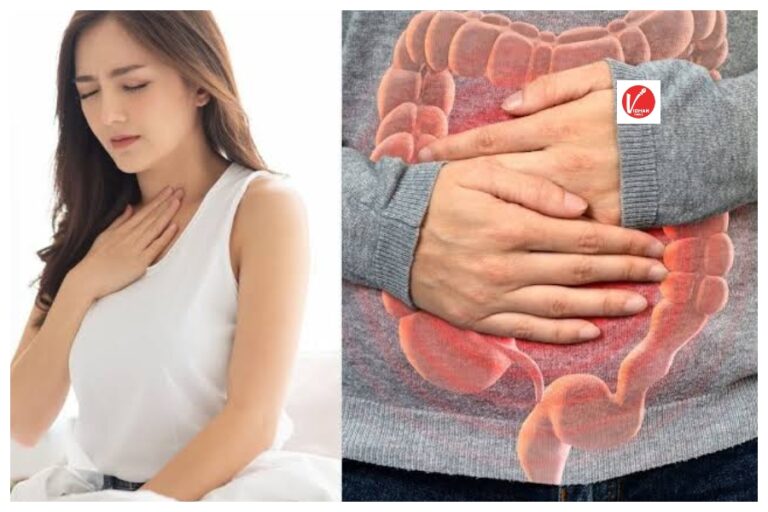 Remedies For Acidity