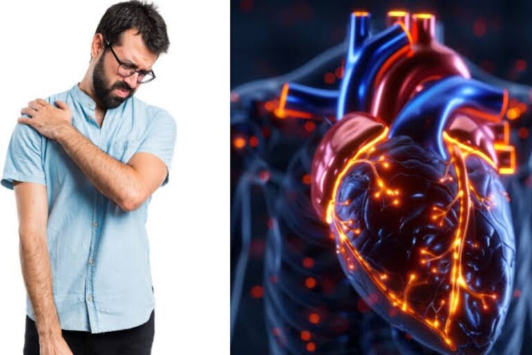 Heart Attack Symptoms: