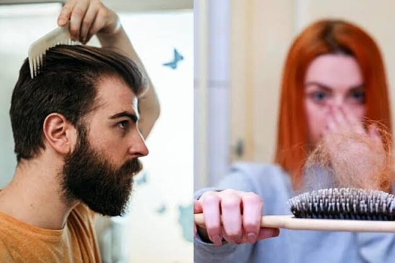 Hair Fall in Winter