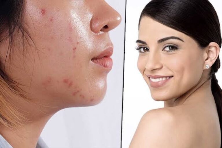 Skin Care Tips: