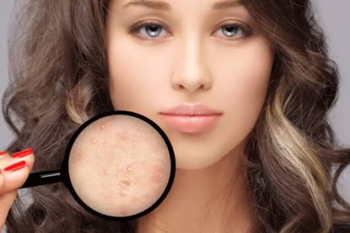 Winter Skin Care Tips