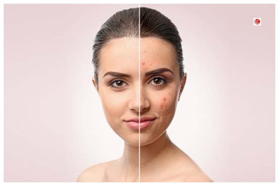 Clean Skin Tips