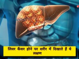 Liver Cancer Symptoms: