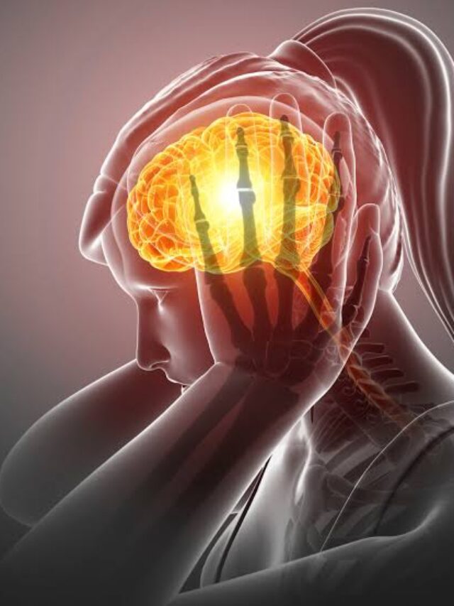 Migraine symptoms