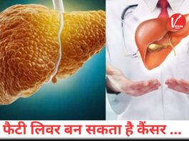 Fatty Liver