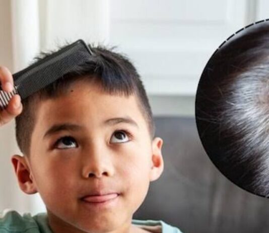 Hair Care Tips: कम उम्र में सफेद हो रहे हैं बाल तो रोजाना करें इन फलो का सेवन Hair Care Tips: