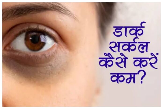 Eye Beauty Tips